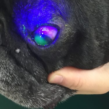 無痛性角膜潰瘍