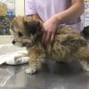 脾静脈ー門脈シャント