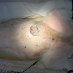 乳腺腫瘍術前の外観